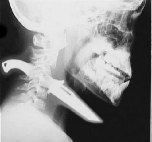 Cosas raras vistas por los rayos x (14)