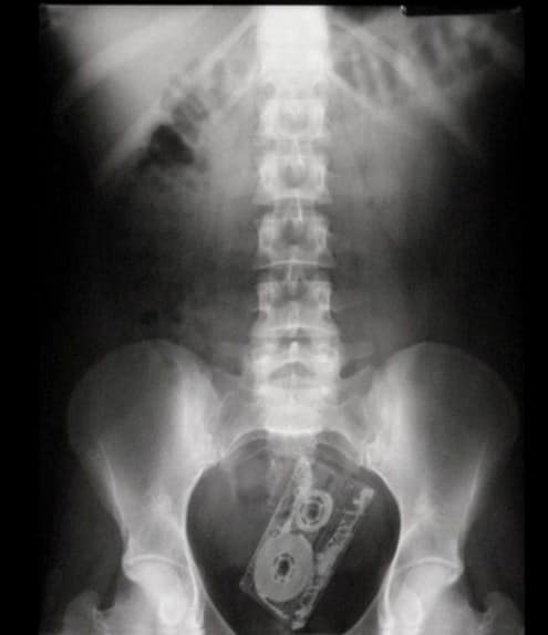 Cosas raras vistas por los rayos x (13)